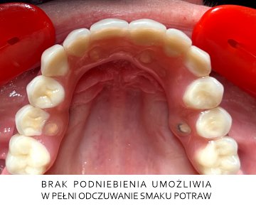 Brak podniebienia umożliwia w pełni odczuwanie smaku potraw